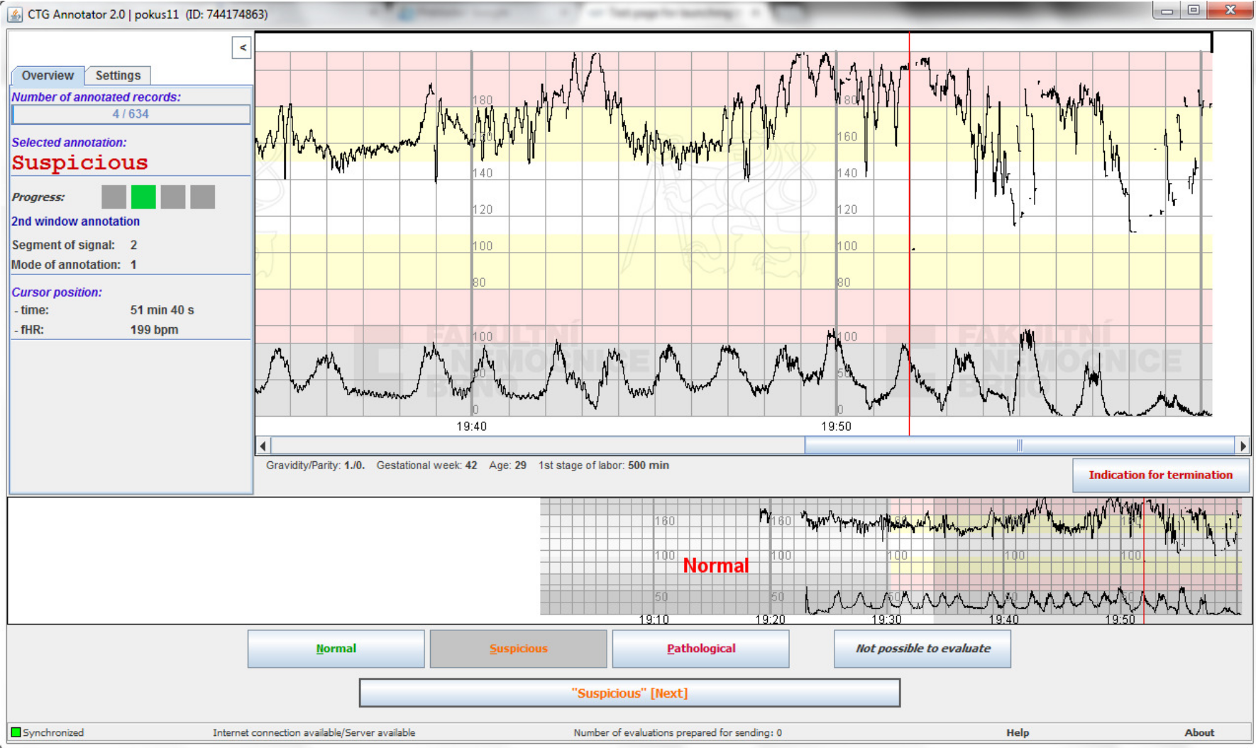 CTG Annotator picture